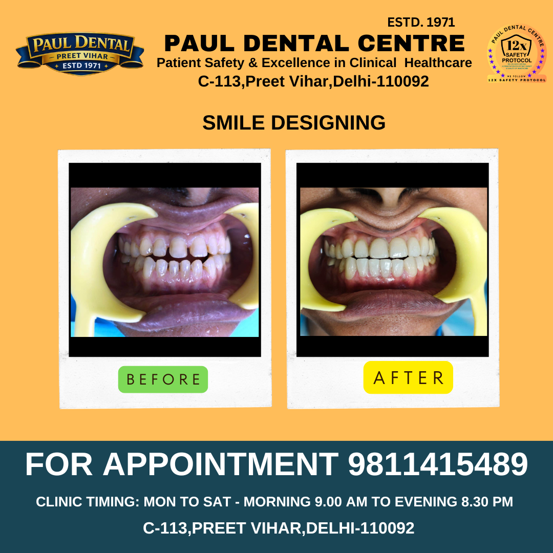 Case 26 – Paul Dental Center